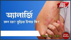 অ্যালার্জির চুলকানির কারণ ও প্রতিকার জেনে নিন