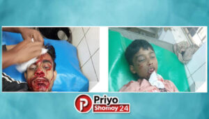 হাজীগঞ্জে পৃথক দুর্ঘটনায় নির্মাণশ্রমিক ও শিশুর করুণ মৃত্যু